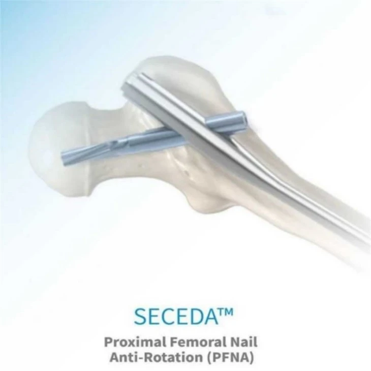 ao intramedullary nail